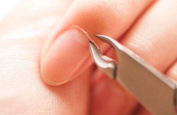 甘皮処理のやり方は？正しい処理方法とメリット・注意点をご紹介